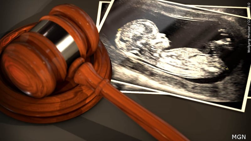 Abortion law